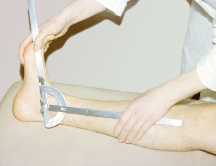 Ротація визначається в положенні хворого на спині, з витягнутими ногами