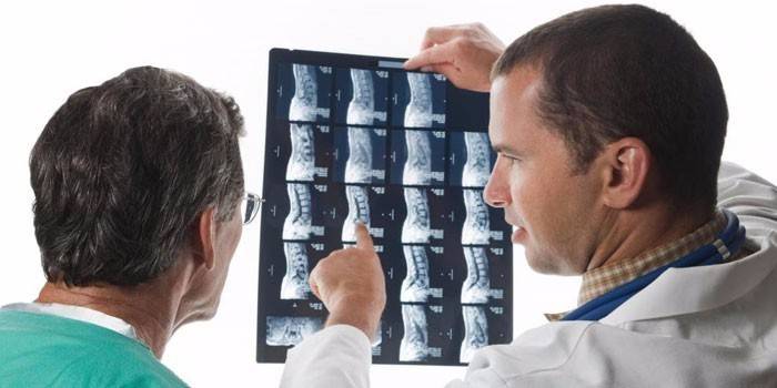 взяття спинно-мозкової рідини (люмбальна пункції);   УЗД спинного мозку;   метод рентгеноскопії, мієлографія;   процедура виявлення порушень провідності нервів;   Комп'ютерна томографія;   МРТ (магнітно-резонансна томографія)